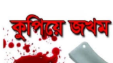 বরিশালে মৎস্যজীবী দলের যুগ্ম আহ্বায়ককে কুপিয়ে জখম
